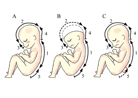 繊維欠乏症を示す 4 つの兆候