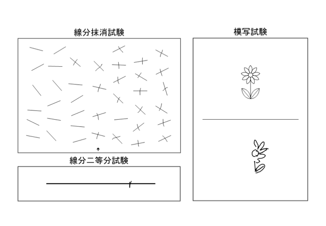 中国のワクチンCoronaVacが第2相試験で有効性を示す
