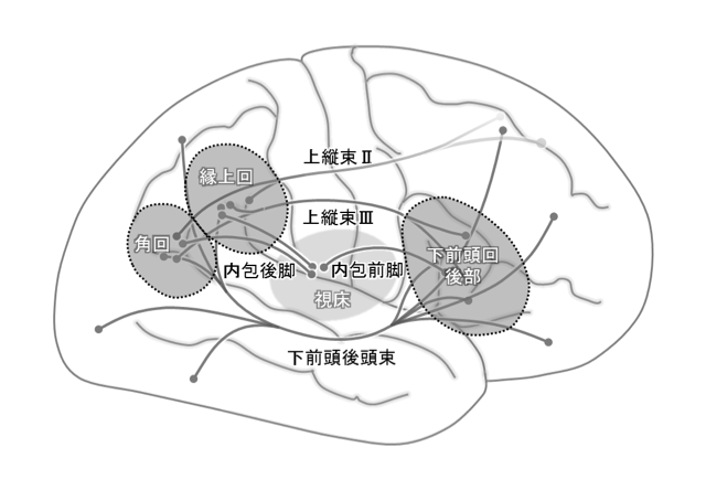 ファイル:脳科学辞典 半側空間無視 図2.png