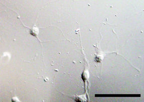 Hippocampal primary neuron.jpg