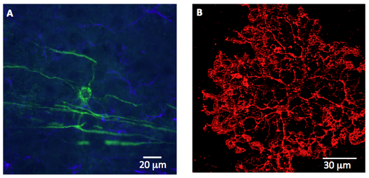 グリア細胞: グリア細胞とは何なのか、どこに存在するのか、機能と種類