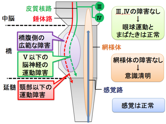希少疾患: 15 の珍しい症候群を発見