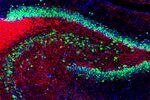 ファイル:Rat hippocampus stained with antibody to NeuN (green), myelin basic protein (red) and DNA (blue).jpgのサムネイル