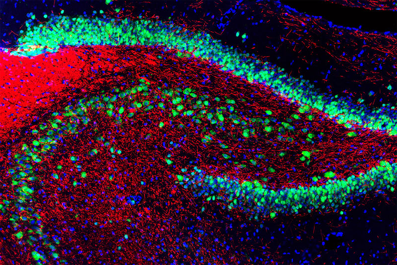 ファイル:Rat hippocampus stained with antibody to NeuN (green), myelin basic protein (red) and DNA (blue).jpg