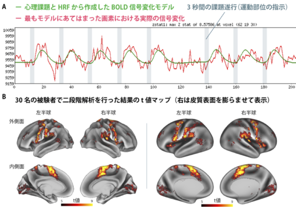機能的磁気共鳴画像法 - 脳科学辞典