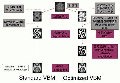 図． VBMの画像処理の流れ（概念図） 従来のstandard VBMでは、欧米の健常者のデータから作成したテンプレートや、組織がその位置に存在している確率情報（Prior probability map）を用いて、空間正規化（Spatial normalization）や組織の区分（Tissue segmentation）を行っていた。それに対して、optimized VBMでは、研究対象からなるサンプルから作成したテンプレートや、組織がその位置に存在している確率情報による画像処理を導入して、空間正規化や組織の分類の精度を高めている。さらに、信号調節による補正（Intensity modulation）を行うことで、空間正規化の非線形変換（Non-linear transformation）のステップで失われた分の解剖学的情報を反映している。