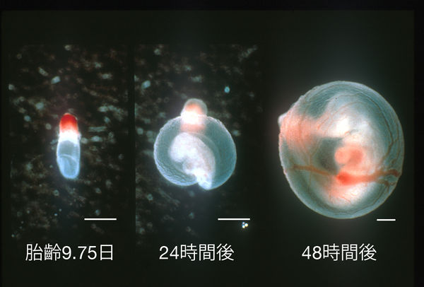 斜視の原因と考えられる治療法