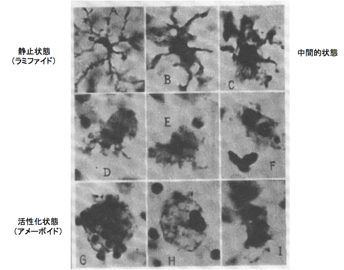 グリア細胞: グリア細胞とは何なのか、どこで見つかるのか、機能と種類 - グリア細胞とは何か、どこで見つかるのか