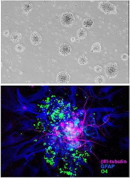 図　マウスES細胞由来のニューロスフェア. 上段：浮遊増殖培養中のニューロスフェア. 下段：接着培養により分化誘導を行ったニューロスフェアの免疫染色像（ピンク：神経細胞、青：アストロサイト、緑：オリゴデンドロサイト）.