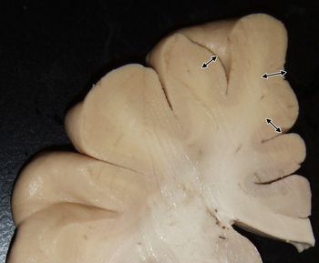 10: あなたの脳は灰色です