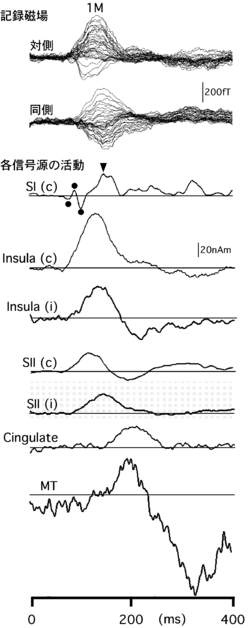 痛みの信号の受信