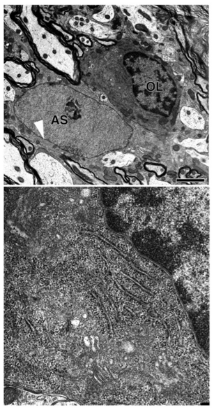 ファイル:図２ 成体マウス脊髄で見られるオリゴデンドロサイト(OL)とアストロサイト(AS).png