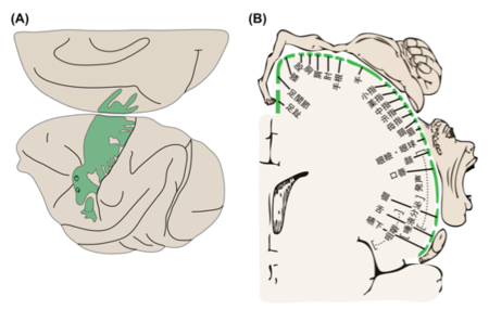 重度の頭痛は病気によって引き起こされる症状の1つです
