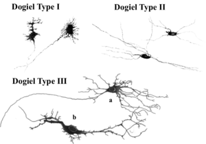 肩の痛み 反射性交感神経性ジストロフィー