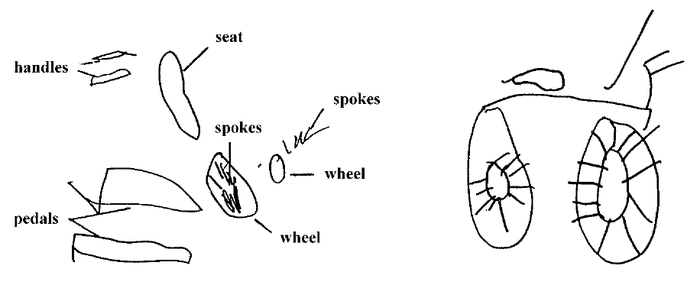 大動脈大腿動脈バイパス術はどれほど深刻か 大動脈大腿バイパス術はどれほど深刻ですか?手術のリスク