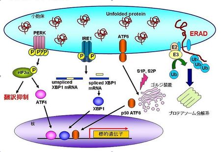 初期段階で現れるアルツハイマー病の新たな症状を科学が発見
