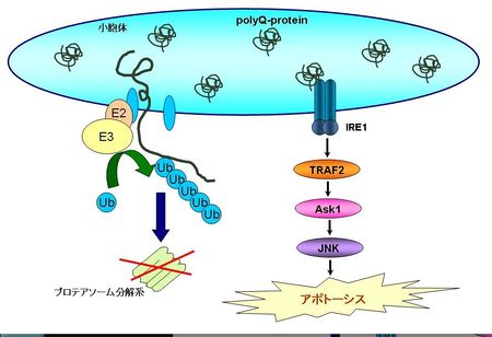 過度の眠気はパーキンソン病の異常な兆候の 1 つである可能性があります