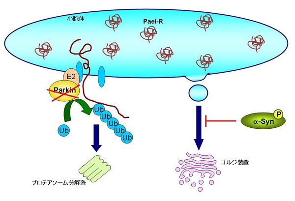 アルツハイマー病の発症につながる可能性のある真菌を科学が発見