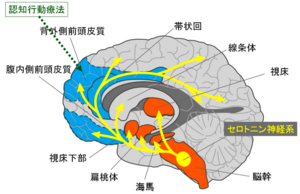 パニック症 - 脳科学辞典