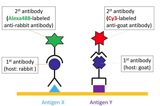 ロシアのワクチン、1か月以内にブラジルで試験される